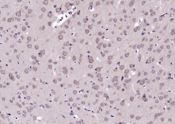 TrkB (phospho-Tyr515) antibody