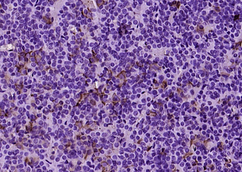 TSHB Rabbit Polyclonal Antibody
