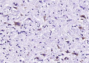 Tuberin Rabbit Polyclonal Antibody
