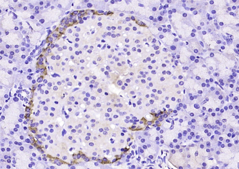 Tuberin Rabbit Polyclonal Antibody
