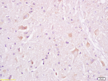 Tuberin Rabbit Polyclonal Antibody
