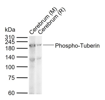 Tuberin (phospho-Ser939) antibody