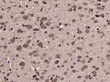 Phospho-Tyk2 (Tyr1054 + Tyr1055) Rabbit Polyclonal Antibody