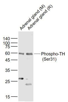 Phospho-TH (Ser31) Rabbit Polyclonal Antibody