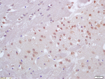 CRX1 Rabbit Polyclonal Antibody