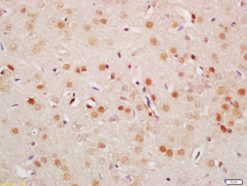 CRX1 Rabbit Polyclonal Antibody