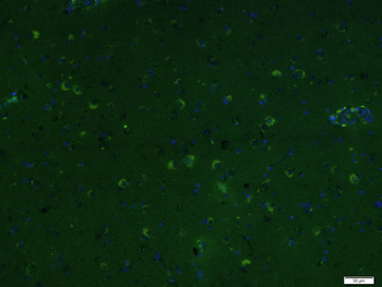 PCGF4/BMI1 Rabbit Polyclonal Antibody (FITC)