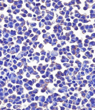 B7-H3/CD276 Mouse Monoclonal Antibody