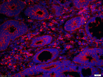 DNase II Rabbit Polyclonal Antibody
