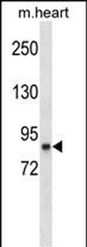 RPS6KA3 Mouse Monoclonal Antibody