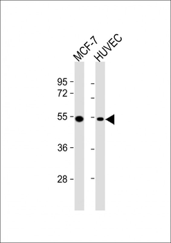 TGF beta 2 Mouse Monoclonal Antibody