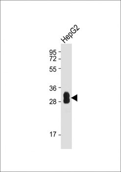 SULT1A1 Mouse Monoclonal Antibody