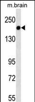 TSC1 Mouse Monoclonal Antibody