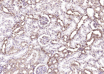 Calreticulin Mouse Monoclonal Antibody