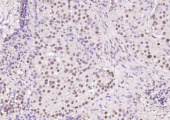 Phospho-AKT1 (Ser124) Rabbit Polyclonal Antibody