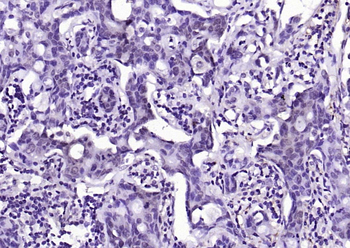 Phospho-AKT1 (Ser124) Rabbit Polyclonal Antibody