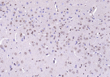 Phospho-AKT1 (Ser124) Rabbit Polyclonal Antibody