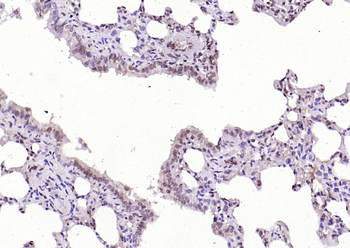 Phospho-AKT1 (Ser124) Rabbit Polyclonal Antibody