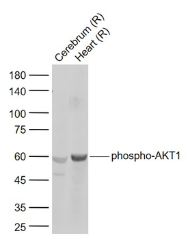 Phospho-AKT1 (Ser124) Rabbit Polyclonal Antibody