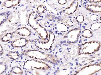 KIF5B Rabbit Polyclonal Antibody