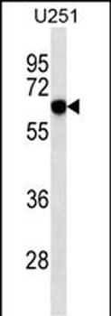 RYK Mouse Monoclonal Antibody