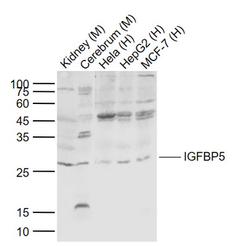 IGFBP5 Rabbit Polyclonal Antibody