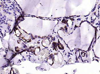 Thyroid peroxidase Mouse Monoclonal Antibody