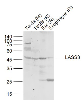 LASS3 Rabbit Polyclonal Antibody