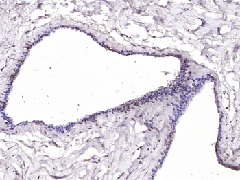 ERK5 Rabbit Polyclonal Antibody