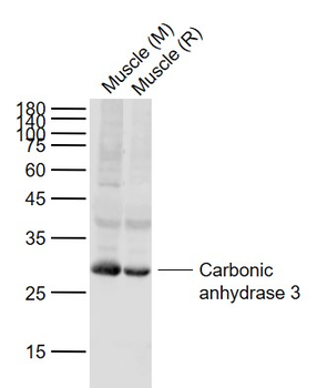 Carbonic anhydrase 3 Rabbit Polyclonal Antibody