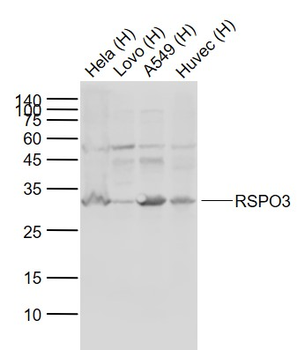 RSPO3 Rabbit Polyclonal Antibody