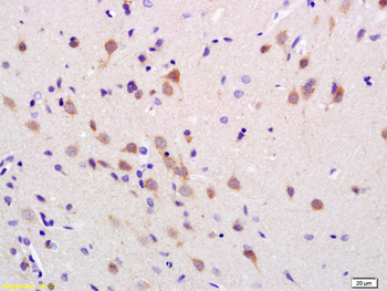 Peripherin Rabbit Polyclonal Antibody