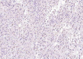 Phospho-Tau (Thr217) Rabbit Polyclonal Antibody