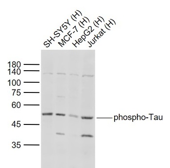 Tau (phospho-Thr217) antibody