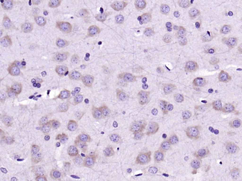 Leptin Mouse Monoclonal Antibody