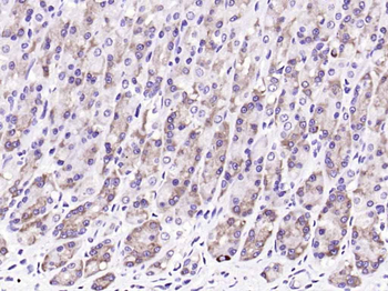 Leptin Mouse Monoclonal Antibody