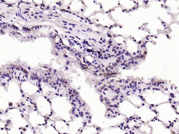 ERK5 Rabbit Polyclonal Antibody