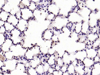 ERK5 Rabbit Polyclonal Antibody
