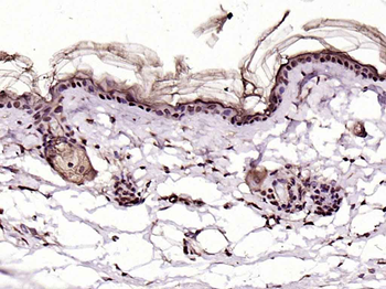 LASS3 Rabbit Polyclonal Antibody