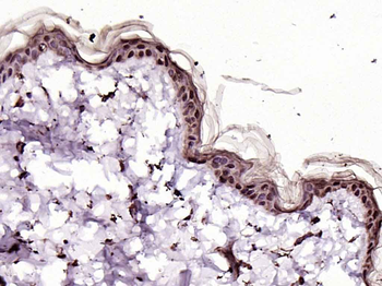 LASS3 Rabbit Polyclonal Antibody