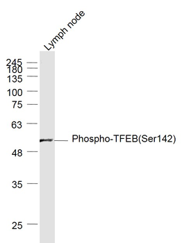 Phospho-TFEB (Ser142) Rabbit Polyclonal Antibody
