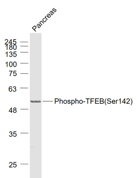 Phospho-TFEB (Ser142) Rabbit Polyclonal Antibody