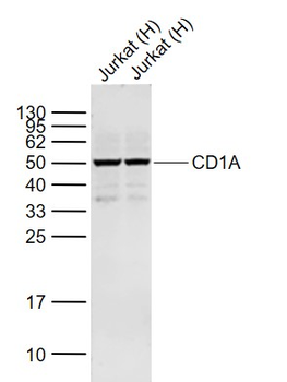 CD1a Rabbit Polyclonal Antibody