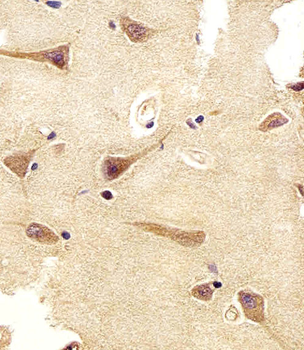 UCHL1/PGP9.5 Mouse Monoclonal Antibody