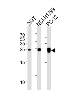 UCHL1/PGP9.5 Mouse Monoclonal Antibody