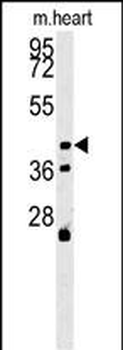 ALDH3A2 Mouse Monoclonal Antibody