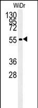 ALDH3A2 Mouse Monoclonal Antibody