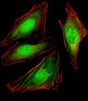 VCP Mouse Monoclonal Antibody