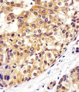 VCP Mouse Monoclonal Antibody