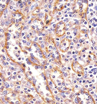 PPP2R1B Mouse Monoclonal Antibody